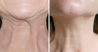 GOPUCE Miracle Neck Cream: Borra las líneas de “cuello de pavo” y “cuello tecnológico”. Elevación visible y suavidad en 4 semanas.