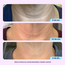 GOPUCE Miracle Neck Cream: Borra las líneas de “cuello de pavo” y “cuello tecnológico”. Elevación visible y suavidad en 4 semanas.